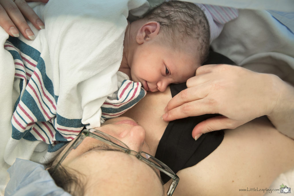 c-section birth photos