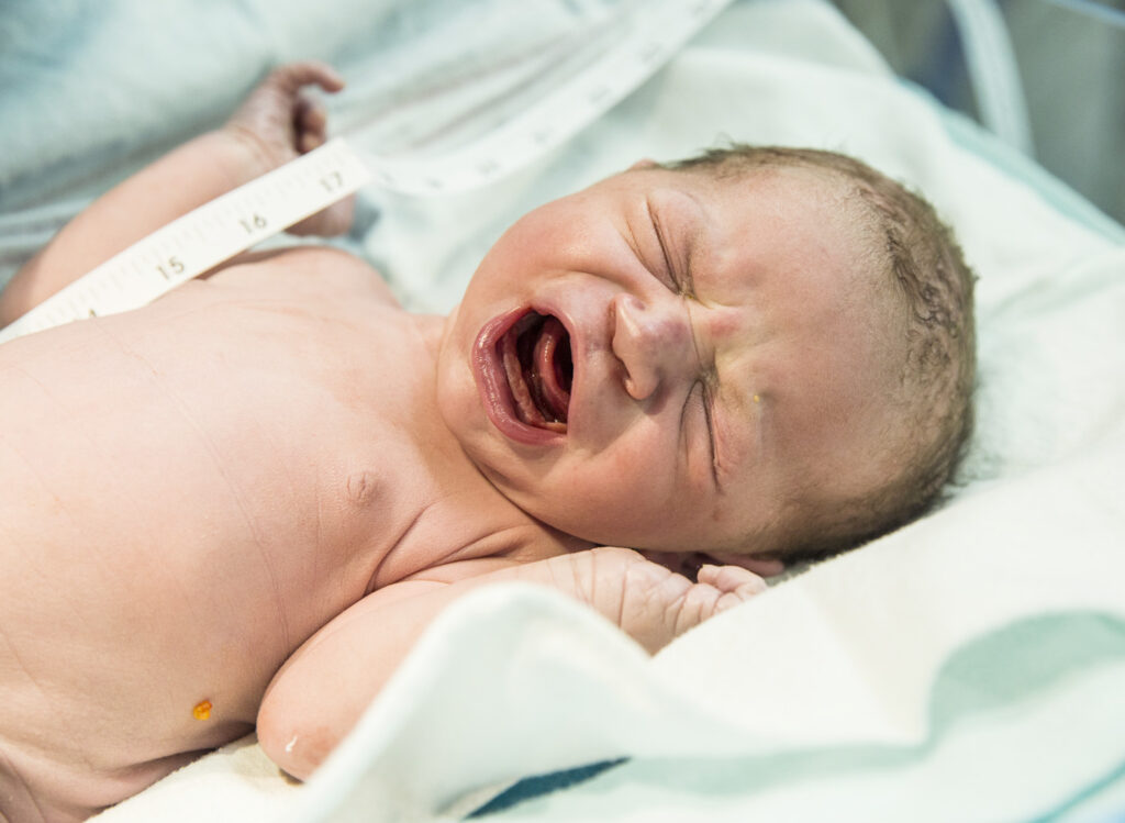 repeat-cesarean